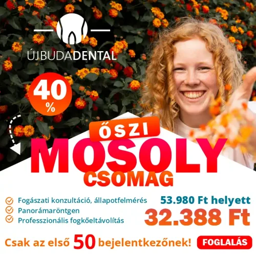 Mosoly ajánlat!